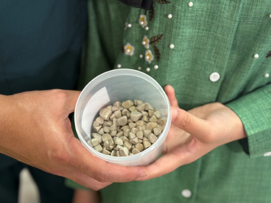 Vücudundan 287 tane taş çıkarıldı, doktorlar bile şok oldu: "Literatürde çok nadir görülen bir olay"