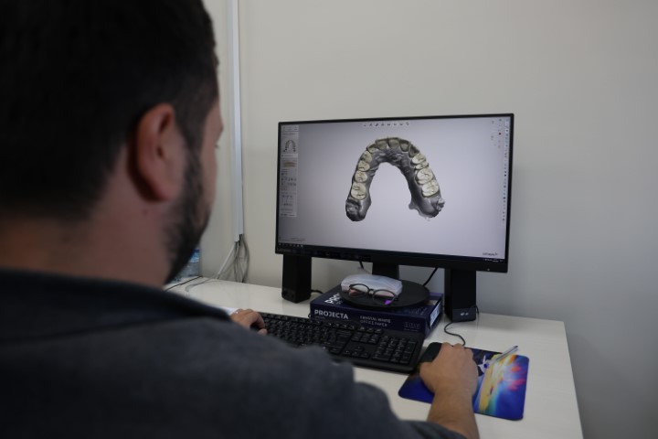 Özelde 8 bin TL olan kaplama, devlet hastanesinde 188 TL’ye yapılmaya başladı