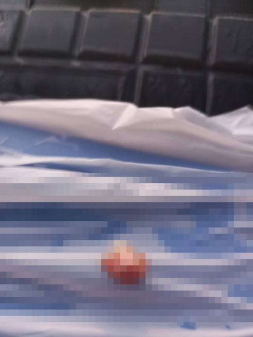 Bursa’da ilkokulda dehşet: Çocuğun parmağı koptu, ders devam etti