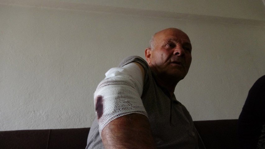 Beslemek istediği köpek saldırdı, koluna 10’dan fazla dikiş atıldı