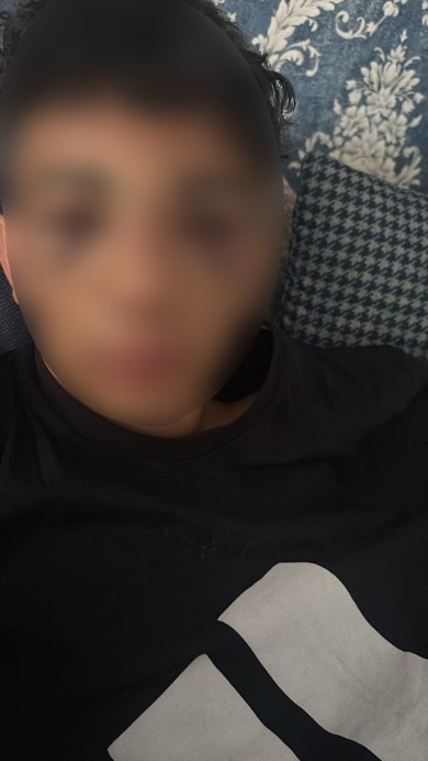 Ağrı’da 14 yaşındaki çocuk konuşma bahanesiyle götürüldüğü yerde 3 kişi tarafından öldüresiye dövüldü