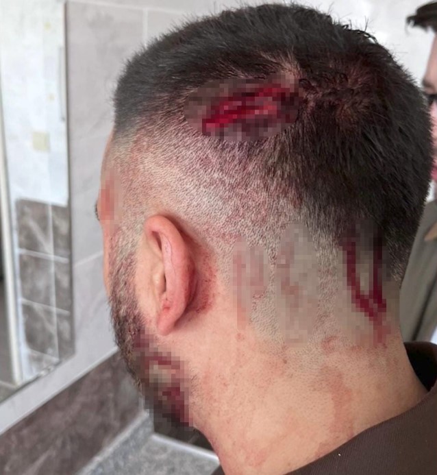 Şanlıurfa’da öğretmen, veli tarafından sopayla darbedildi