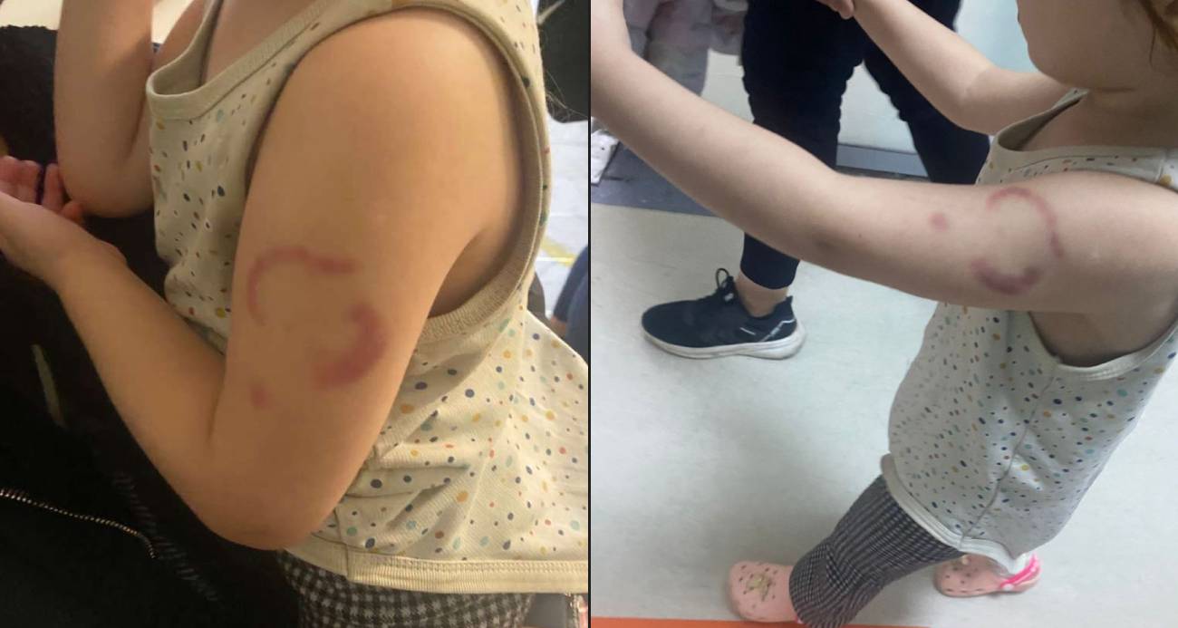 Özel kreş öğretmeni 3 yaşındaki çocuğa dehşeti yaşattı