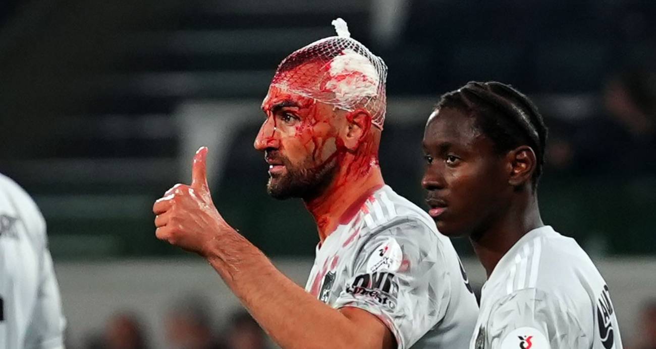 Serdar Dursun ve Jerome Opoku hava topu mücadelesinde çarpıştı