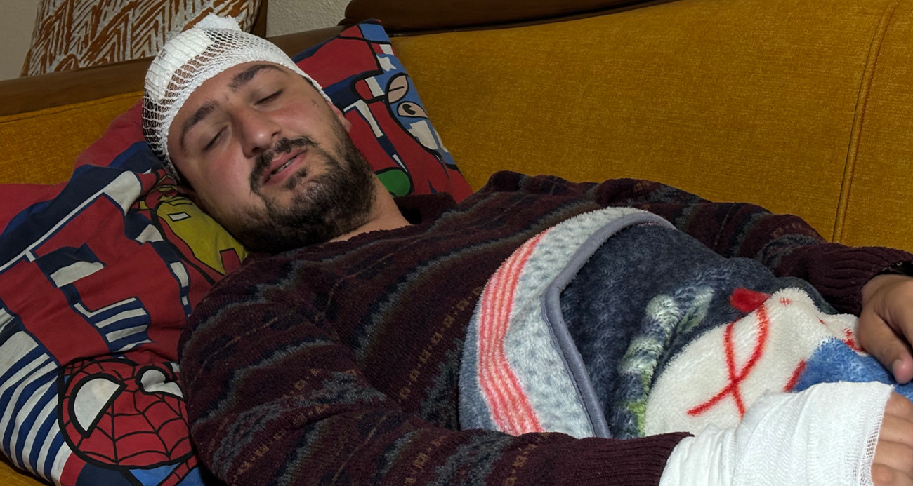 Vicdanları yaralayan olay: Otizmli şahıs odunluğa baktı diye odunla darbedildi