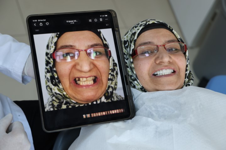 Depremlerden etkilendi, diş tedavisinde implantı rafa kaldıracak cam fiber uygulamasını geliştirdi