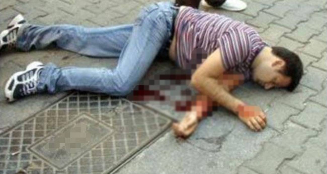 'Kedi gibi 9 canlı', 7 defa ölümden döndü: Elektrik akımına kapıldı, beton zemine kafa üstü çakıldı