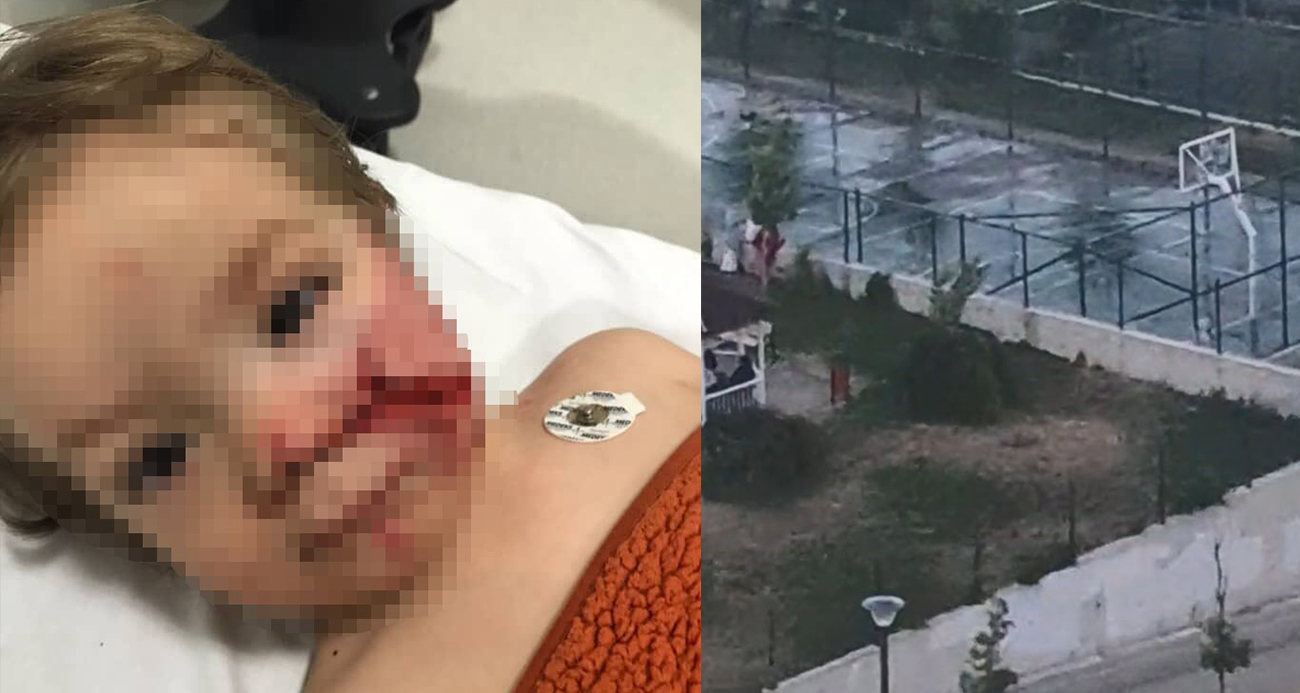 Ankara’da iki kardeşe saldıran pitbullun sahibinin, köpeğini tasmasız ve ağızlıksız gezdirdiği görüntüler ortaya çıktı