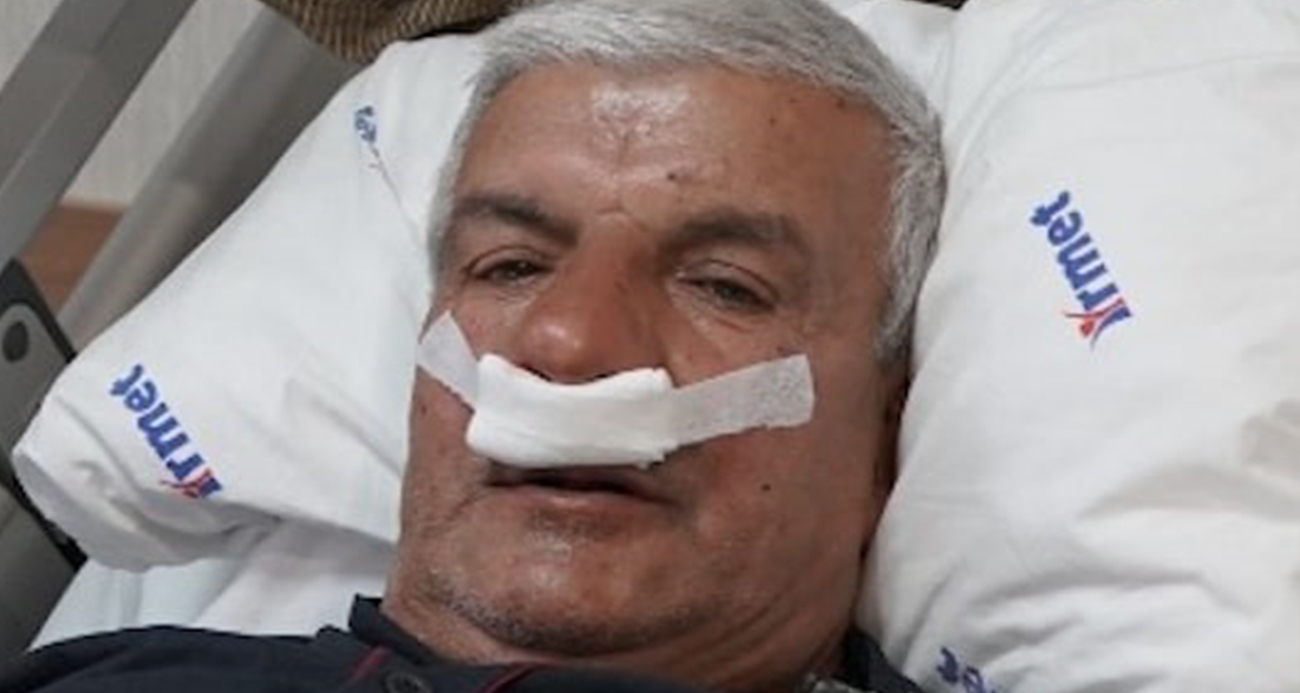 65 yaşındaki adamın burnundan 100 gramlık taş çıkarıldı