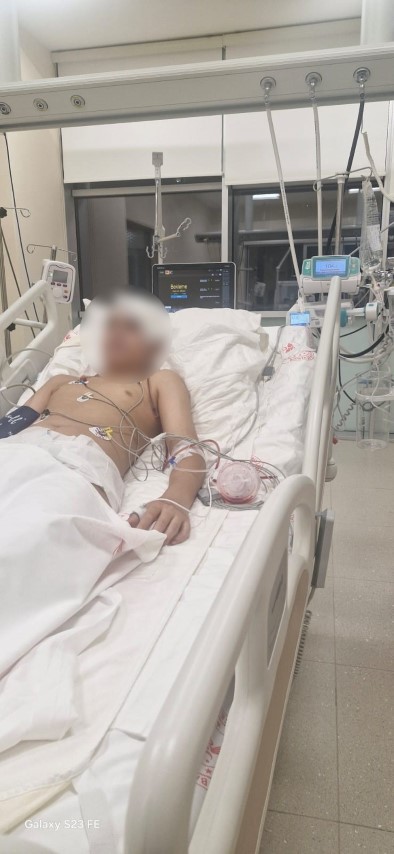 Akran zorbalığına maruz kalan 13 yaşındaki çocuğun kafatası titanyum parçalarıyla yeniden oluşturuldu