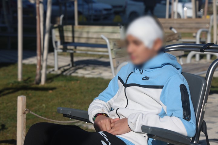 Akran zorbalığına maruz kalan 13 yaşındaki çocuğun kafatası titanyum parçalarıyla yeniden oluşturuldu