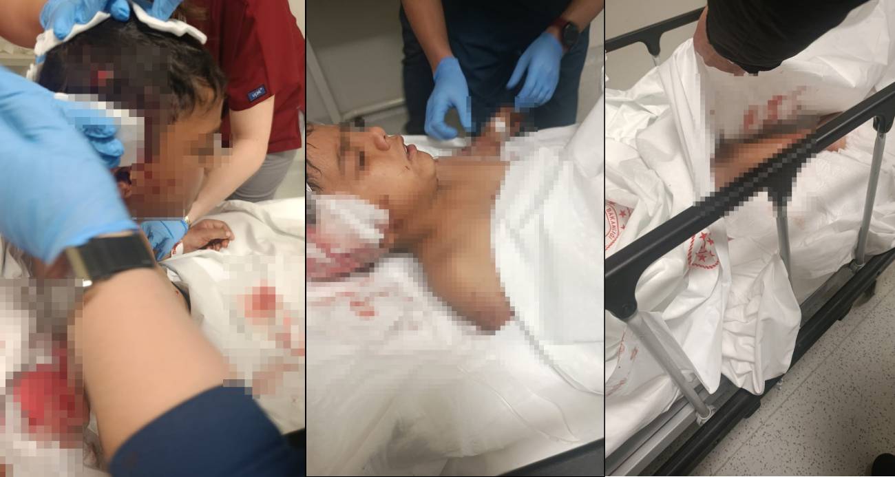 Ankara’nın Altındağ ilçesinde okuldan evine dönen bir çocuk, başıboş köpeğin saldırısı sonucu yaralandı.