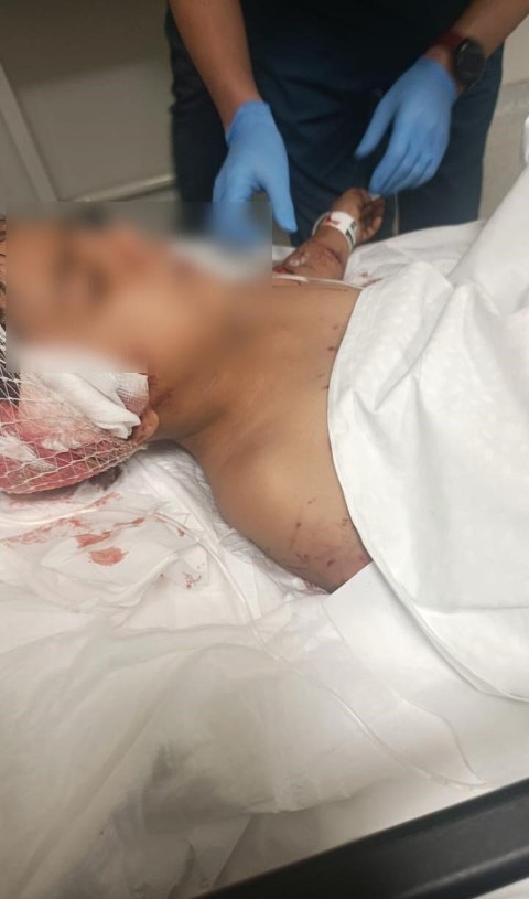 Köpeklerin saldırısına uğrayan çocuğu kurtaran komşu: 