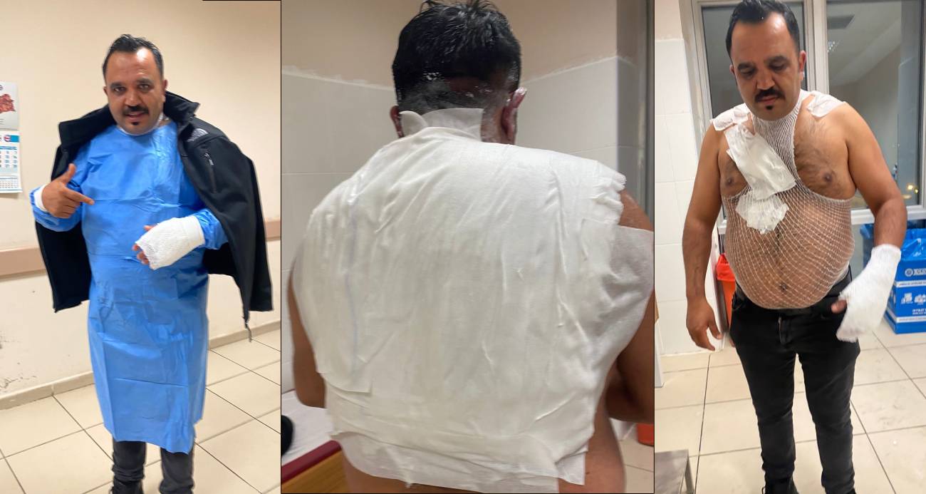 Meşhur tostçu, soğuk havada şov yapmak isterken kendini yaktı