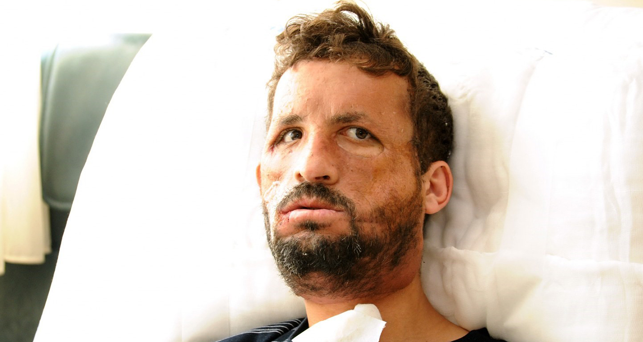 Hayata 14 yıldır başka bir yüzle bakıyor