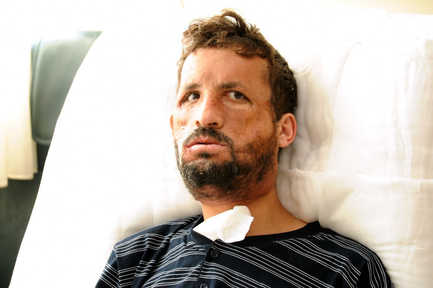 Hayata 14 yıldır başka bir yüzle bakıyor: Türkiye’nin ilk yüz nakli, 14 yıl sonra yeni hayatının mimarlarıyla yeniden buluştu