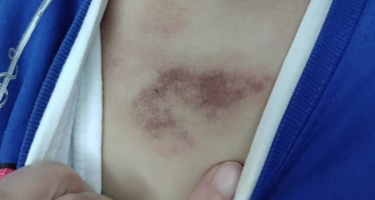 İBB’ye bağlı kreşte yaşananlar ilişkin ifade veren mağdur çocuk: 