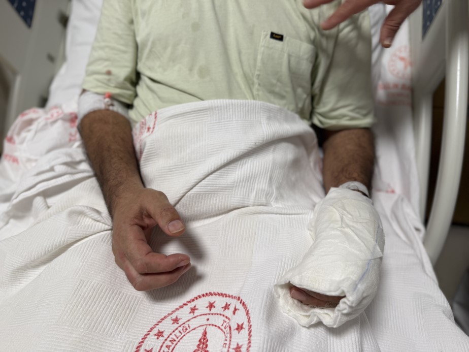 Sıcak su torbasının patlamasıyla vücudunun yüzde 30’u yandı: "5 dakika geçti, patladı"