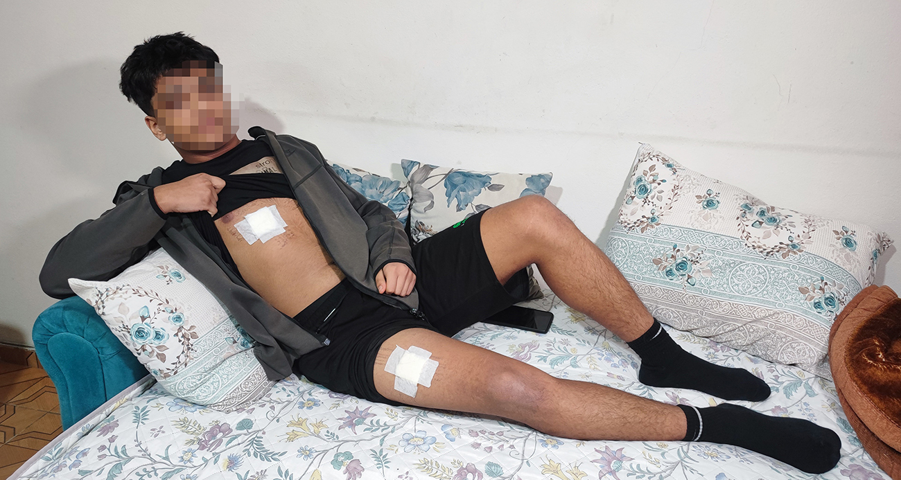 Akran zorbalığı az kalsın öldürüyordu: Önce dövüldü sonra bıçaklandı