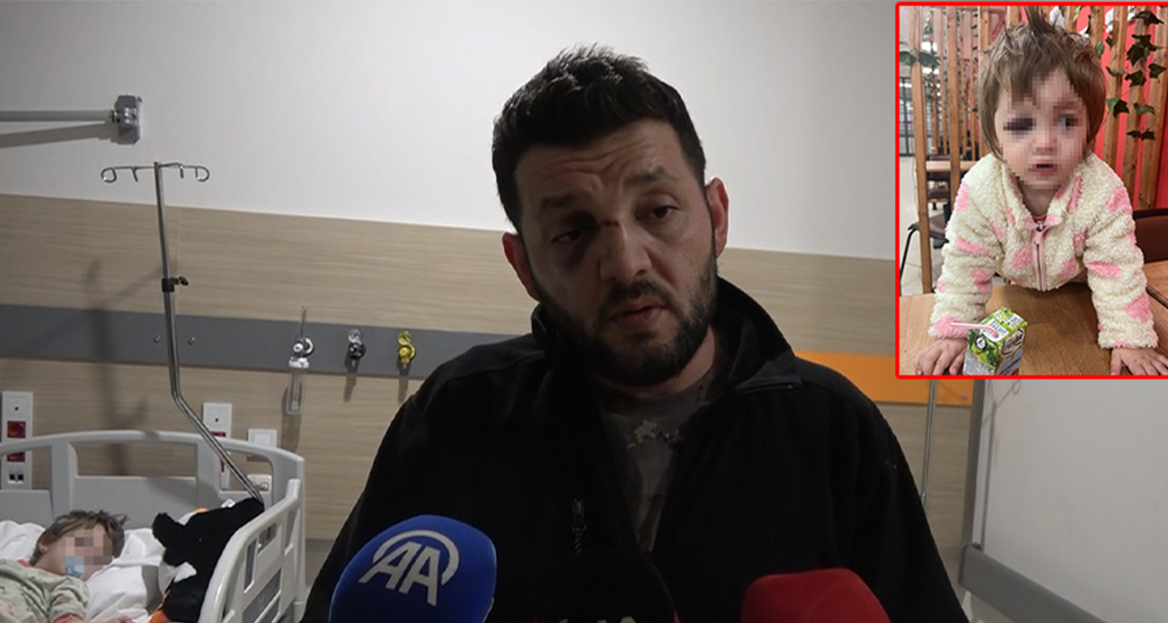 Yalova’nın Çınarcık ilçesinde gürültü nedeniyle aralarında husumet olan komşularının saldırısına uğrayan babanın burnu, kucağındaki 14 aylık kızının ise kafatası çatladı.