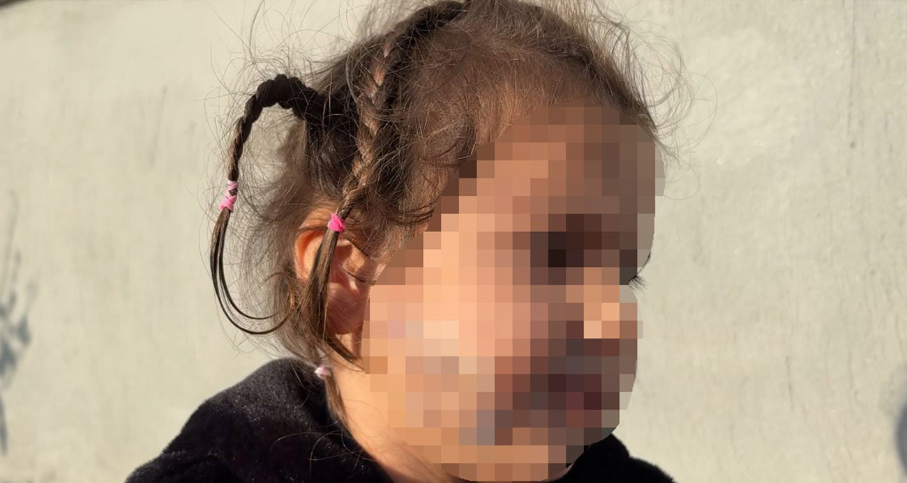 İzmir’de köpek dehşeti: 3 yaşındaki Ada’nın yüzü pençe ve ısırıkla dolu - ASAYİŞ