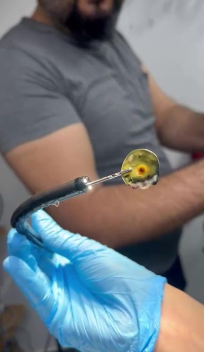 Dört yıldır kusan kedinin midesinden buzdolabı vakumu çıktı