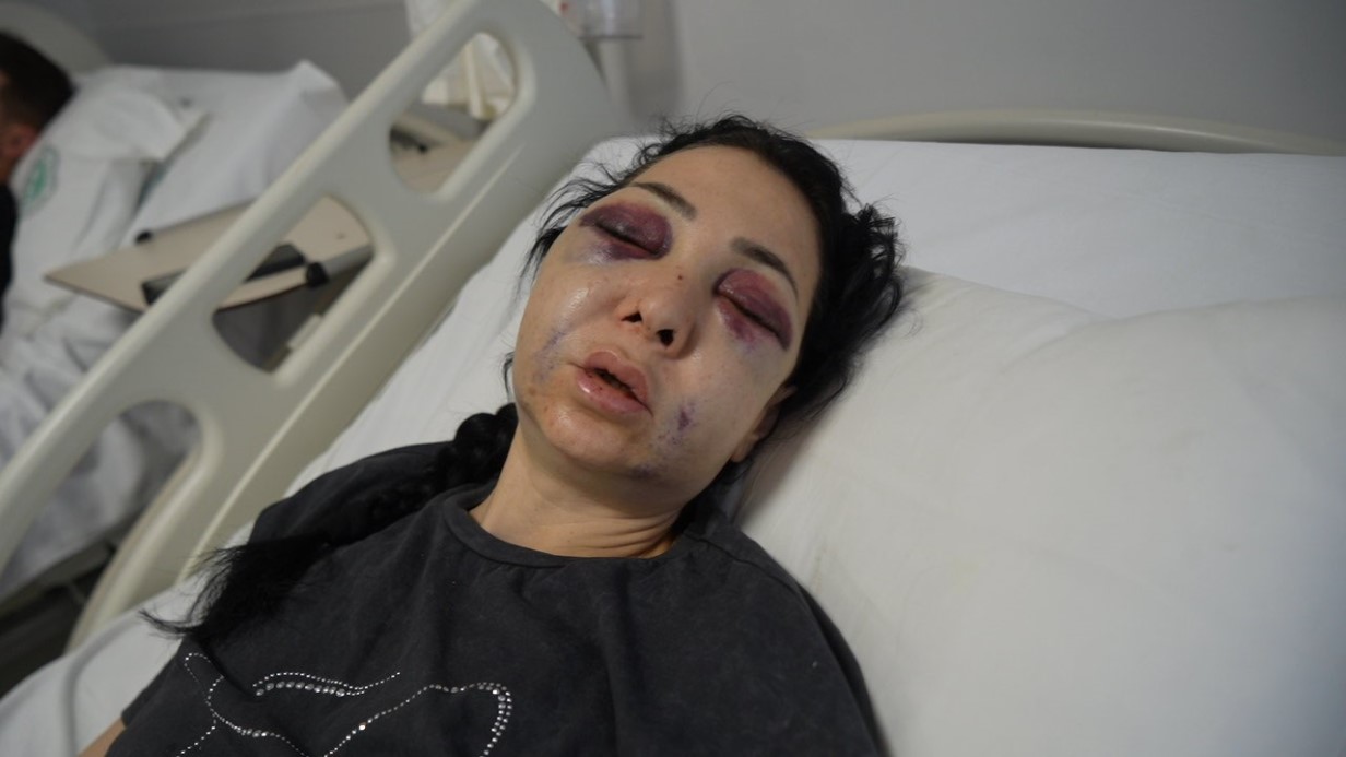 Oğlunun gözü önünde anneyi öldüresiye dövdüler: Yüzü tanınmaz halde