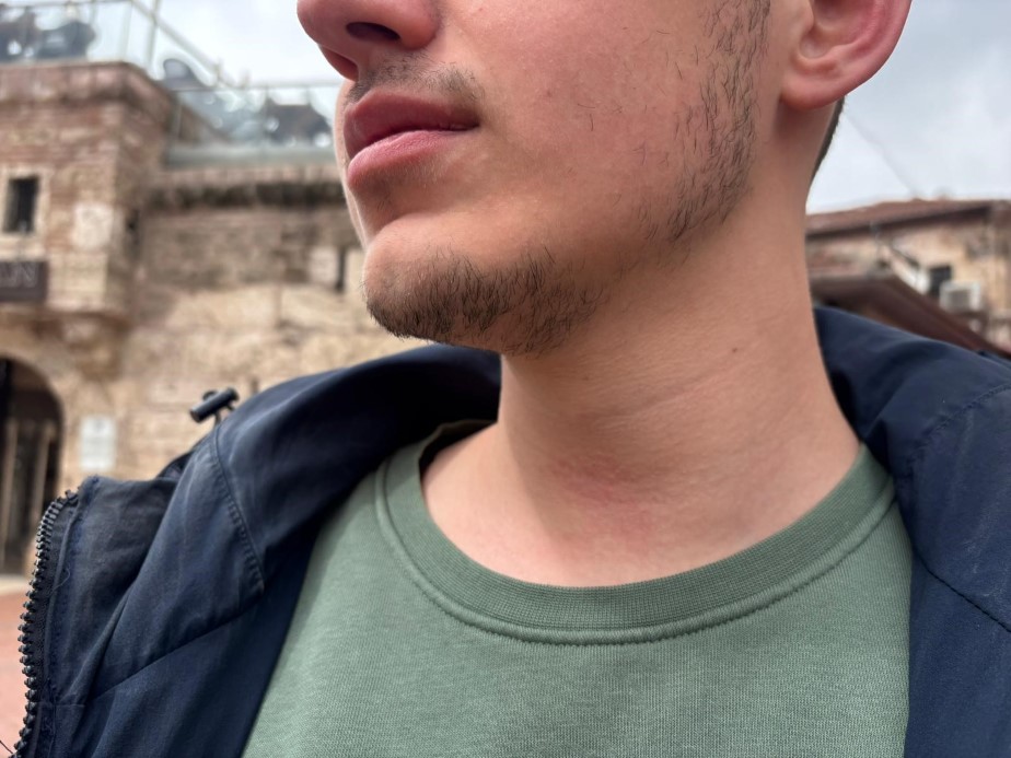 Bolu’da haber takibi yapan muhabir darbedildi