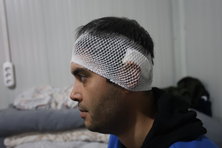 Bayram günü konteyneri delip geçen yorgun merminin kafasına isabet etmesiyle kabusu yaşadı