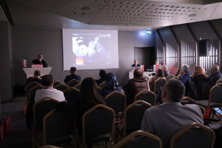 Kontrolsüz içilen ağrı kesiciler, bağırsak sağlığını bozuyor