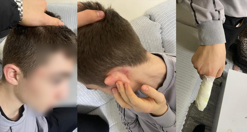 Hırsızlık yaptı sandılar, 14 yaşındaki çocuğu tekme tokat dövdüler; o anlar kamerada