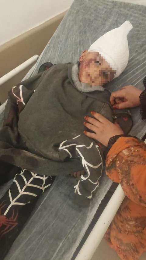 3 yaşındaki çocuğuna köpek saldıran baba: 