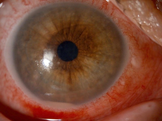 ’Kırlangıç otu kullanımı’na dikkat, uzmanlar uyarıyor: