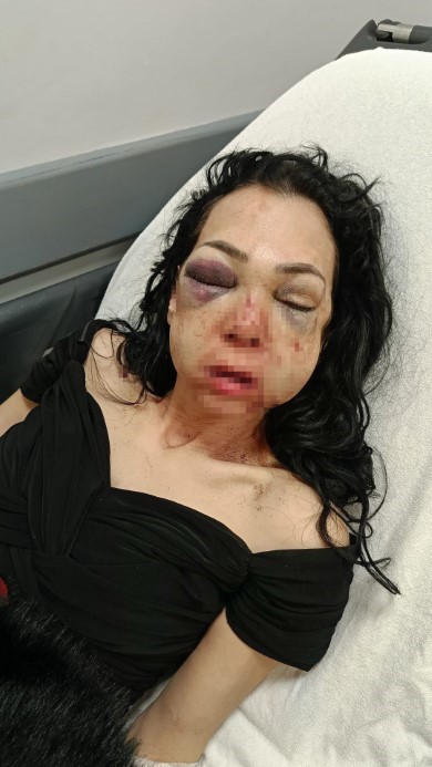 Anne ve oğlunu öldüresiye darp eden şüpheliler: 