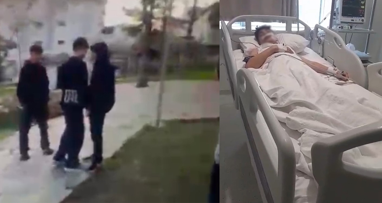 Yaşıtını bıçakla ağır yaralayan çocuk saldırı anını da kayda aldırdı