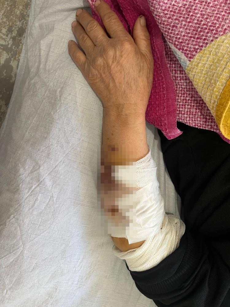 Köpek sürüsünün saldırısında ağır yaralanan yaşlı kadın: 