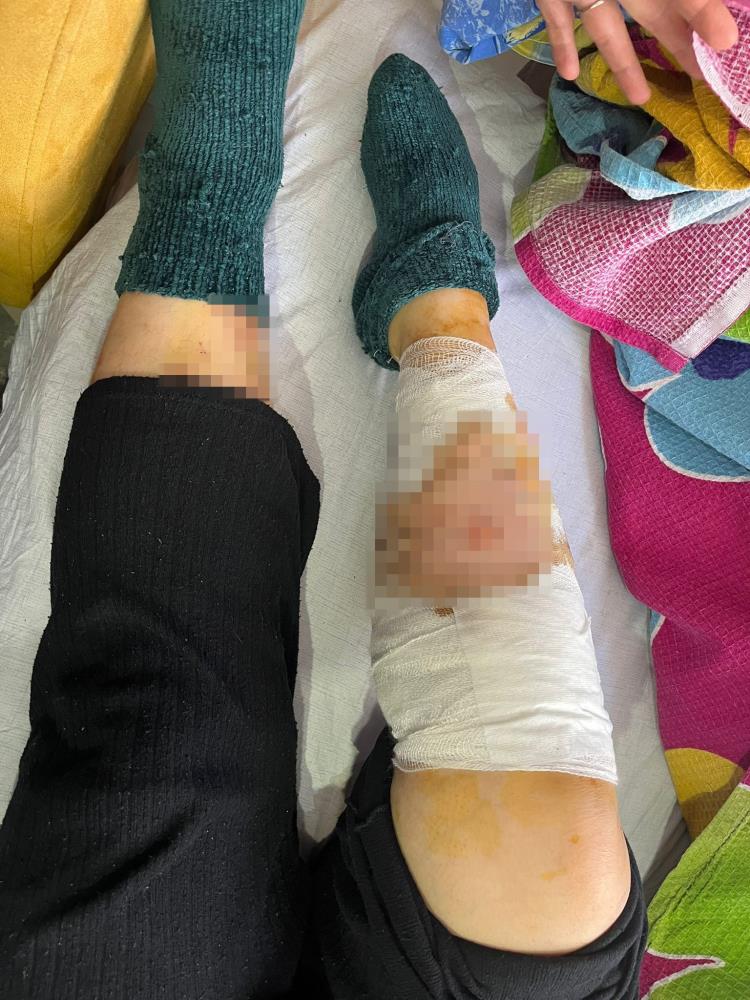 Köpek sürüsünün saldırısında ağır yaralanan yaşlı kadın: 