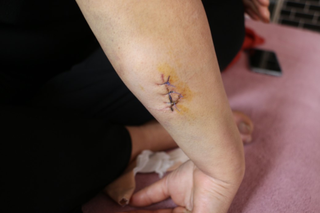 Diyarbakır’da dehşet: Nikahlı eşini 30 yerinden bıçakladı