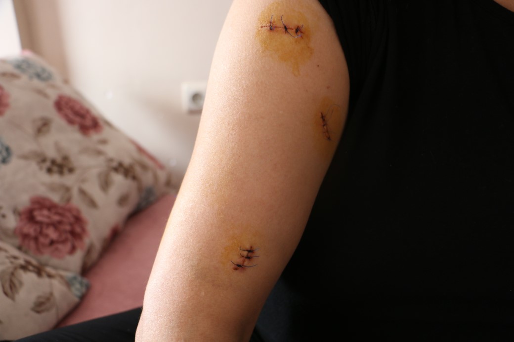 Diyarbakır’da dehşet: Nikahlı eşini 30 yerinden bıçakladı