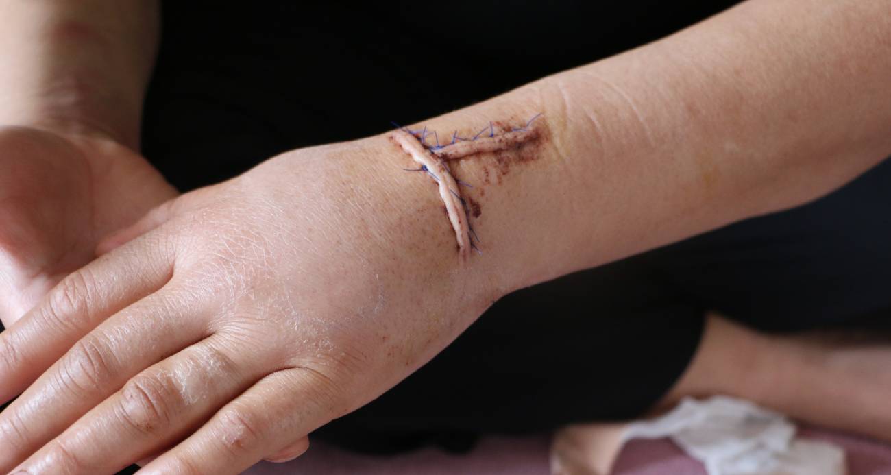 Üç gün yoğun bakımda kalan kadın, saldırganın tahliye edilmesi halinde hayatının tehlikede olduğunu belirterek koruma talep etti.