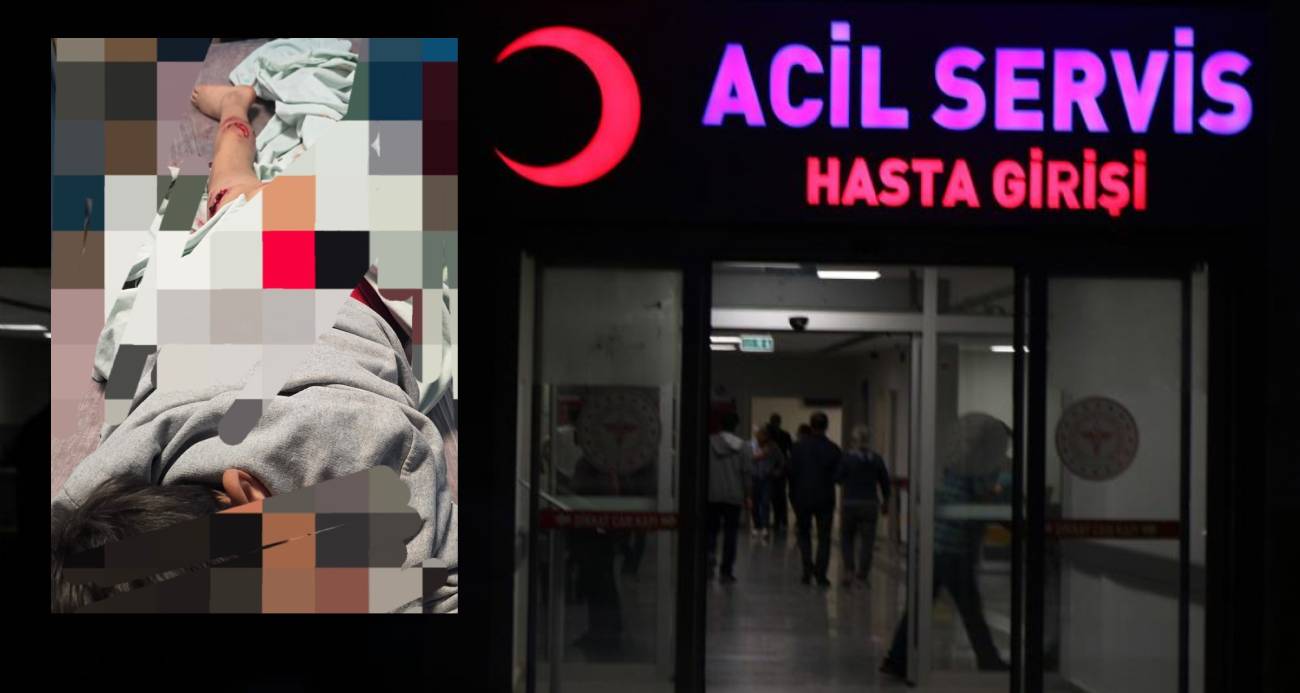 Van’da sokak köpeği dehşeti: Parçalanmaktan son anda kurtuldu