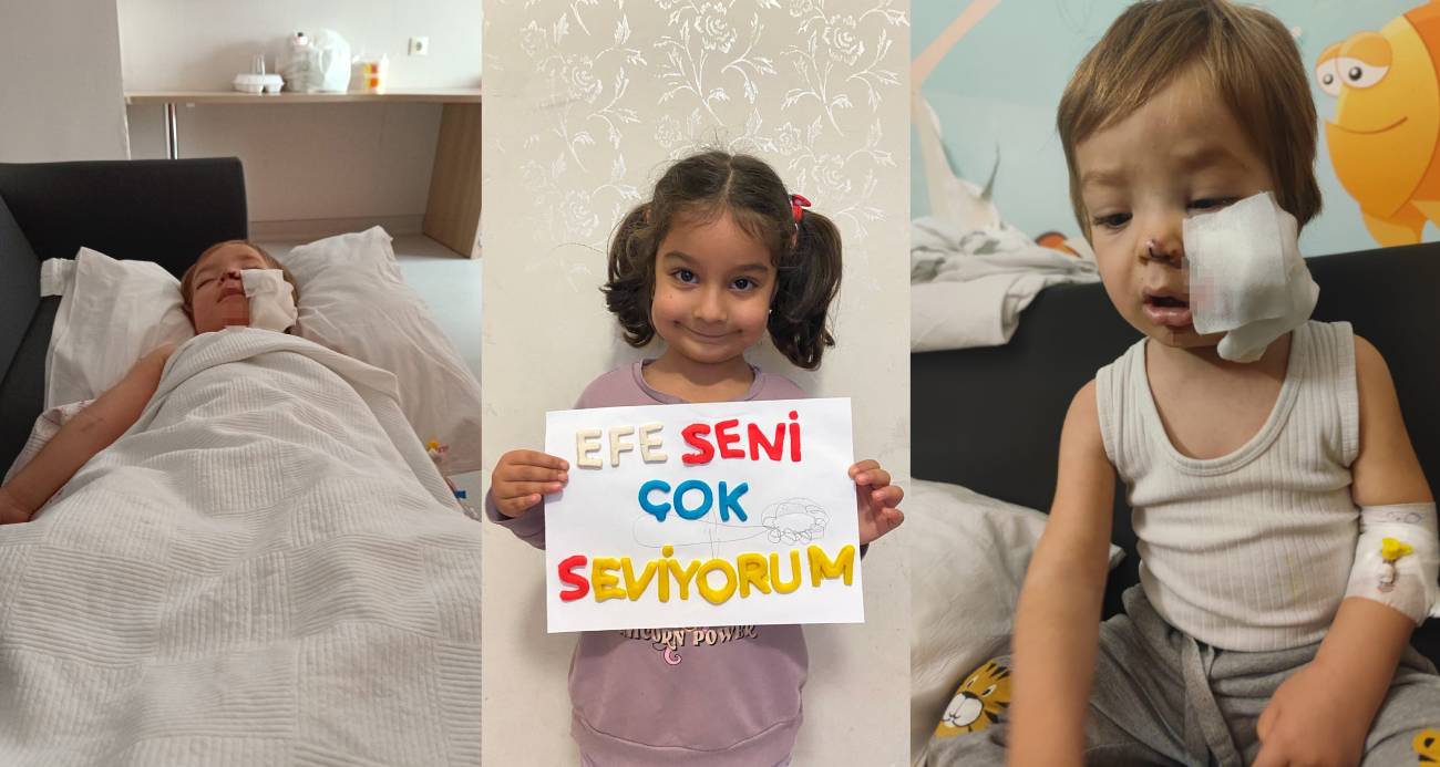 Ankara’da iki çocuğu pitbull saldırısına uğrayan Baba: 