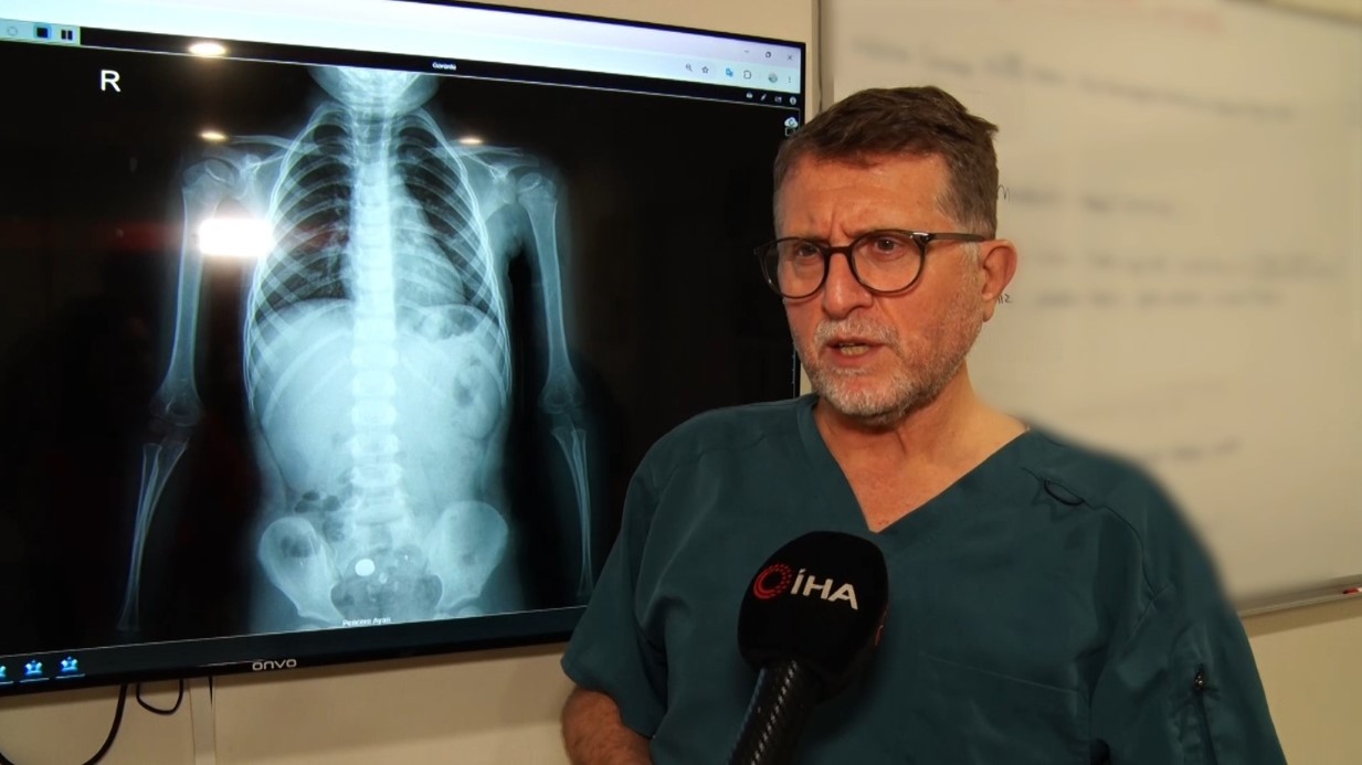 Şeker sanıp yuttu, pil olduğu filmde ortaya çıktı: 