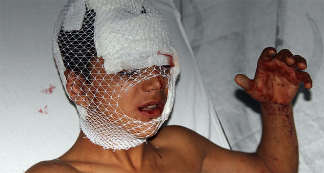 Samsun'da köpek dehşeti