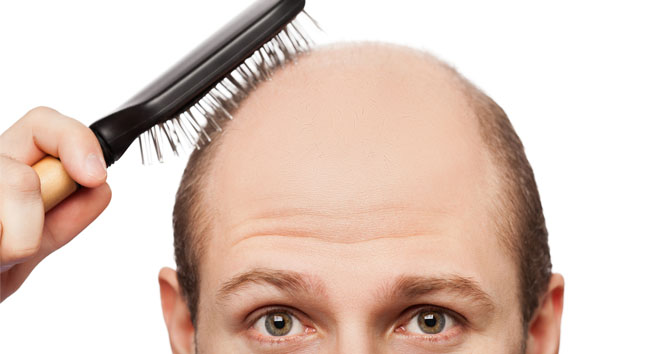 Saç ektiren erkeklerin öz güveni artıyor