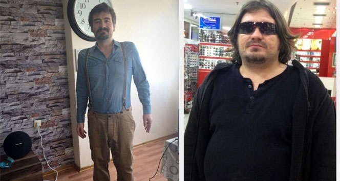 Tüp mide ameliyatıyla 9 ayda 55 kilo verdi