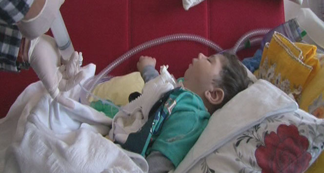 Minik Taha'nın 5 ayrı makineye bağlı hayat mücadelesi