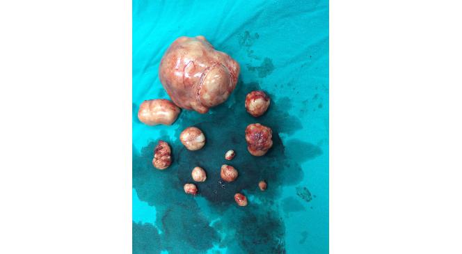 Rahminden 12 Adet Ur Çıktı