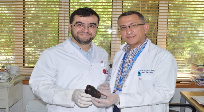 16 Yaşındaki Kızın Midesinden 190 Gram Taş Çıktı