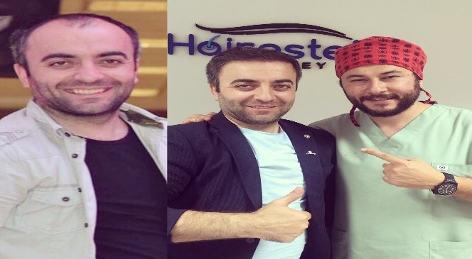 Saç ekiminde tepe kısma dikkat